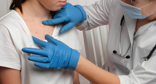 Morbillo, negli USA record di casi in 35 anni: colpa del calo dei vaccini